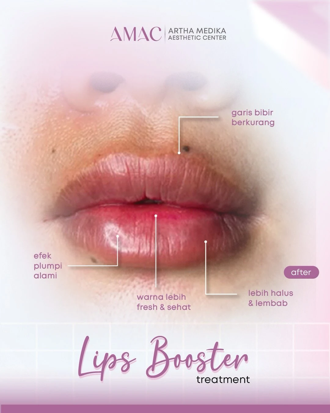 Desain feed Lips Booster — Informasi Treatment